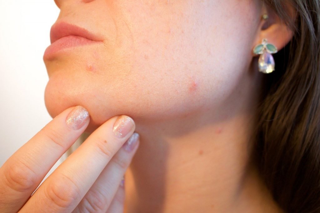 huidtherapeut www.skin-prof.nl Pixabay